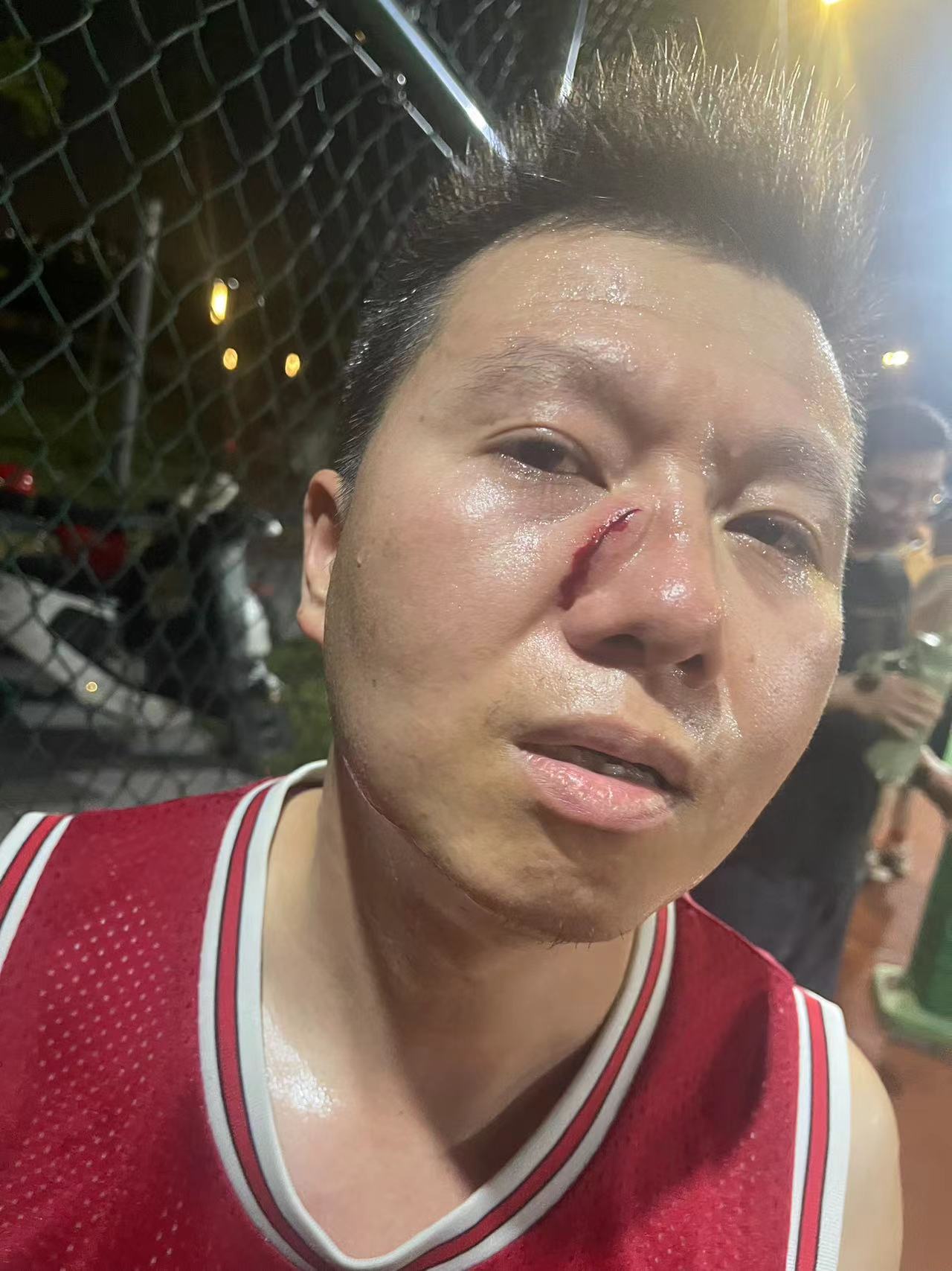 篮球明星球员受伤，球队战绩受到影响